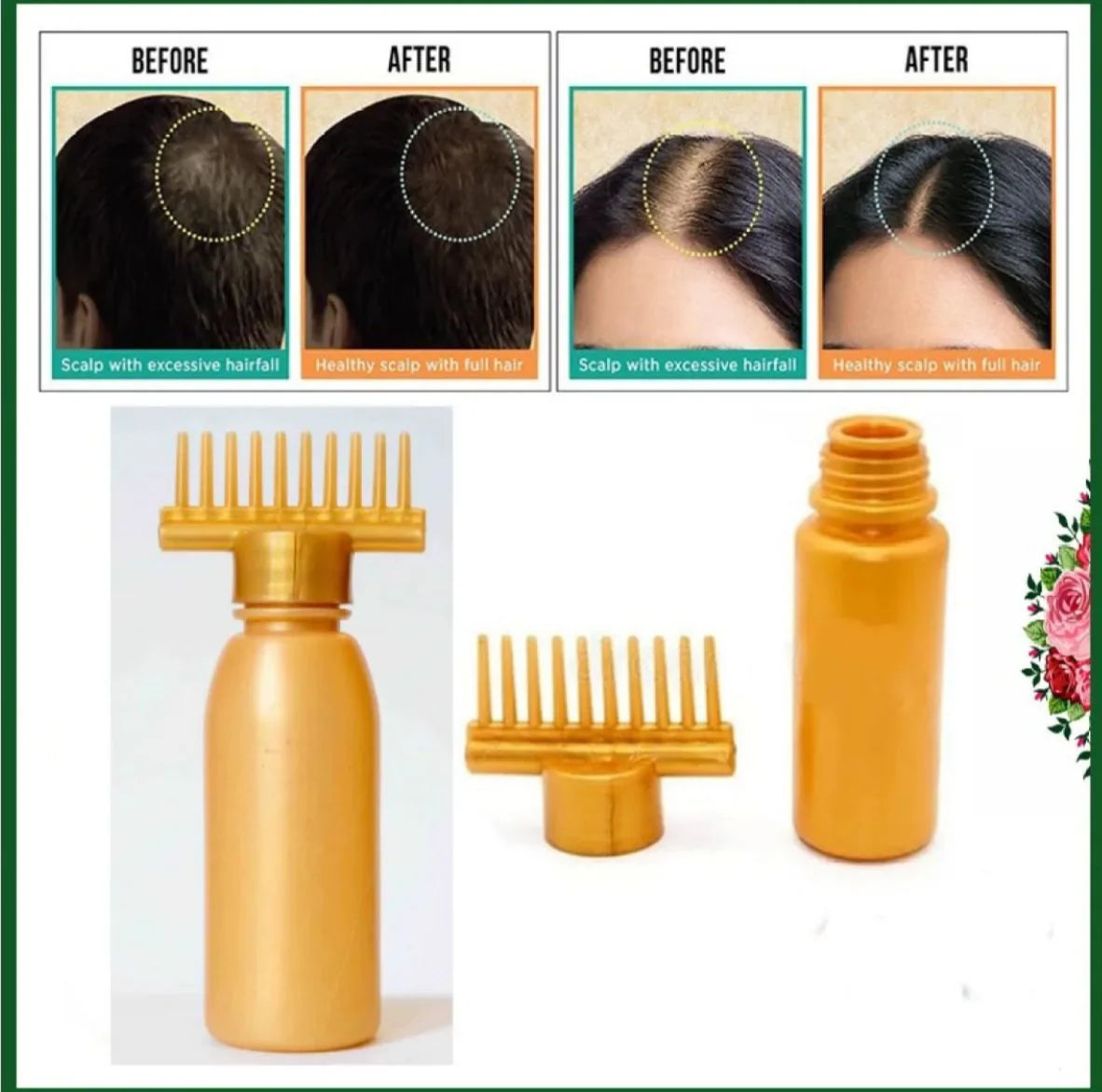Hair Oil Applicator Bottle with Massage Comb