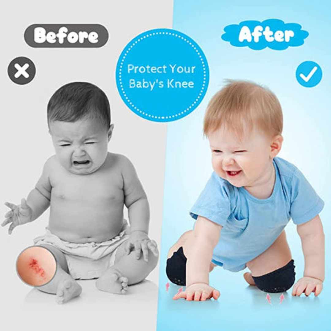 Set of Baby Knee Pads and Elbow Cushions for Safety While Crawling