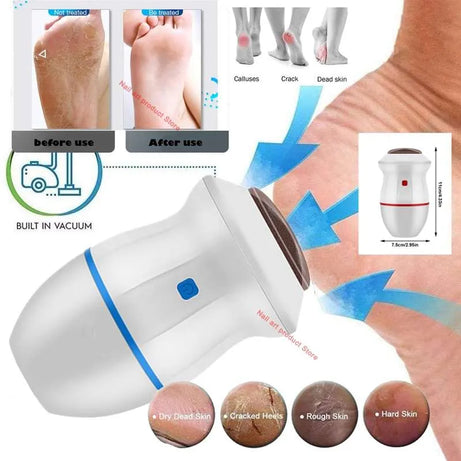 Portable USB Rechargeable Electric Callus Remover for Feet with Built in Vacuum Removes Dead Skin from Foot