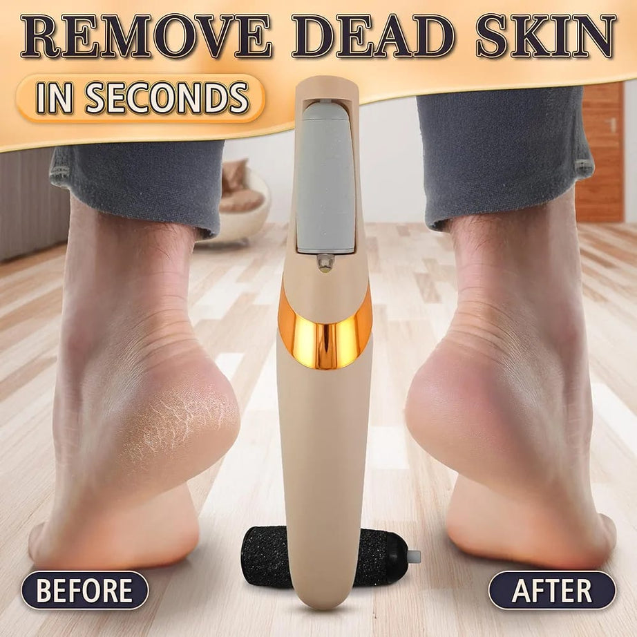 Electric Callus Remover – Smooth, Soft & Salon