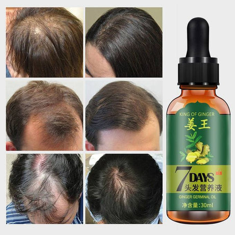 GINGER GERMINAL OIL for fast hair growth